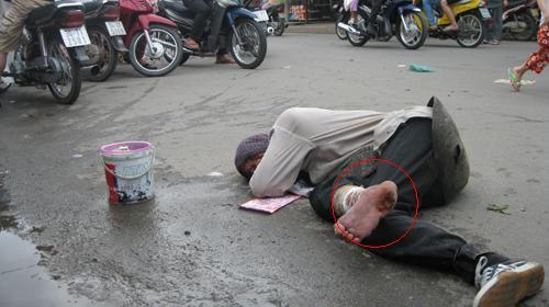 Lật tẩy trò lừa ăn xin - Tuổi trẻ Lật tẩy trò lừa ăn xin - Tuổi trẻ